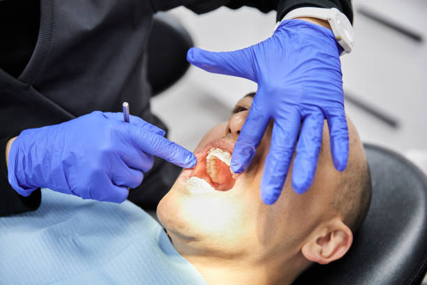 Best Emergency Root Canal Treatment in Bratenahl, OH