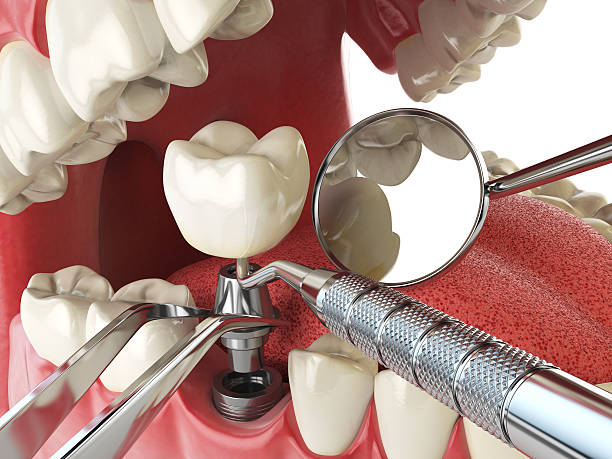 Best Broken or Cracked Tooth Emergency Dentist in Bratenahl, OH
